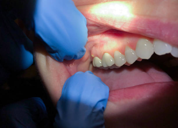 Best Urgent Care for Lost Fillings or Crowns in Alsip, IL
